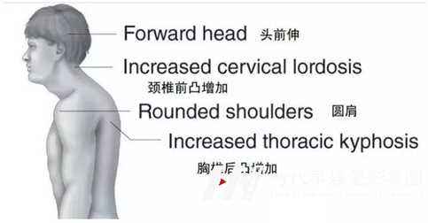 深圳少儿模特形体矫正机构-孩子驼背怎么办(图4) 图片