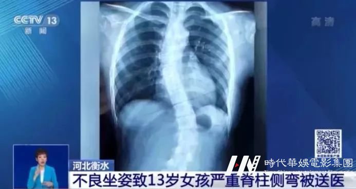关注青少年体态健康,学习少儿模特养成良好形体!(图3) 图片